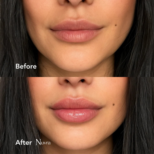 Hyaluronic Acid Lip Plumper